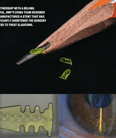Fortune Glaucoma Stent